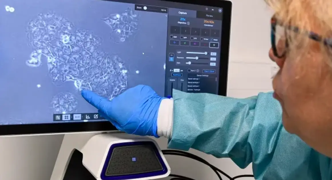 Два препарата от рака поджелудочной показали обнадеживающие результаты