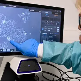 Два препарата от рака поджелудочной показали обнадеживающие результаты