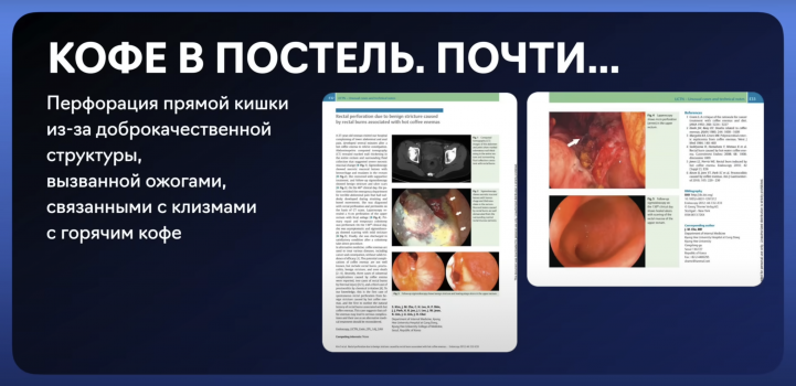 Слайд из лекции Алексея Водовозова «Что такое чистки организма и есть ли в них рациональное зерно»  